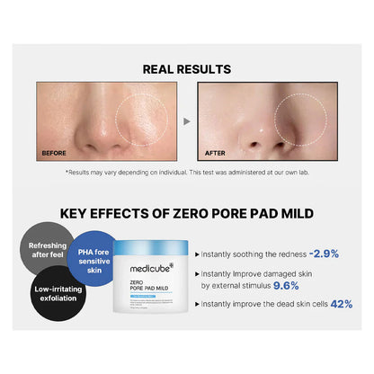 Zero Pore Pad 2.0